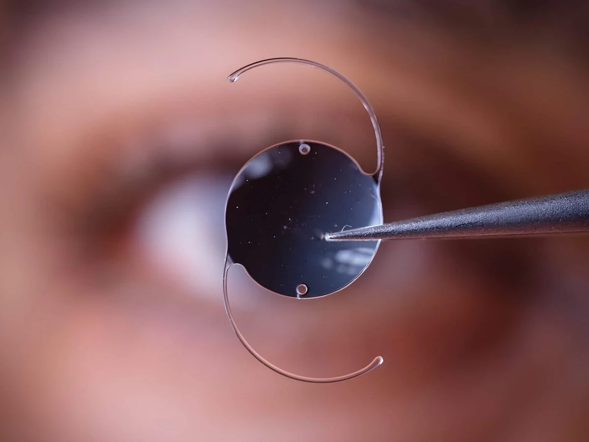 Trifokal akıllı lens (göz içi mercek)