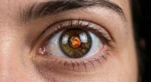 Retina Lazeri ve Göz İçi İğne Tedavisi